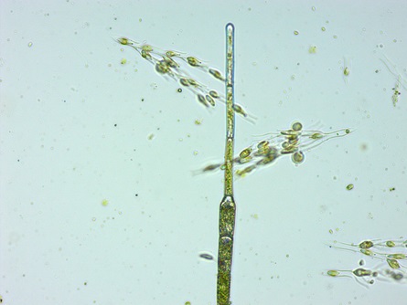 Dinobryon algae