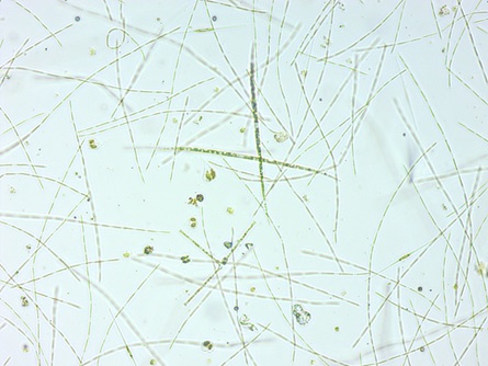 Filamentous algae