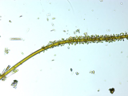Filamentous algae
