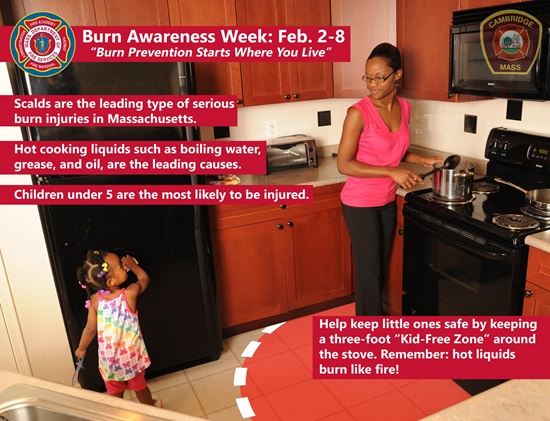 Burn Awareness in the kitchen